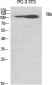 Rb Polyclonal Antibody