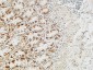 Rb Polyclonal Antibody