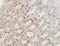 Rb Polyclonal Antibody