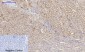 Rock-1 Polyclonal Antibody