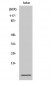 S-100A10 Polyclonal Antibody