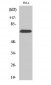 SDHA Polyclonal Antibody