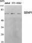 SENP1 Polyclonal Antibody