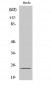 SENP8 Polyclonal Antibody