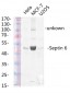 Septin 6 Polyclonal Antibody