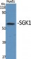 SGK1 Polyclonal Antibody
