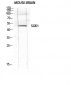 SGK1 Polyclonal Antibody