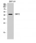 SIRT2 Polyclonal Antibody