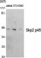 Skp2 p45 Polyclonal Antibody