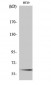 Smad2 Polyclonal Antibody