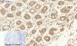 Smad2 Polyclonal Antibody