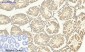Smad4 Polyclonal Antibody