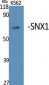 SNX1 Polyclonal Antibody
