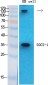 SOCS-1 Polyclonal Antibody