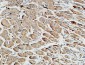 Somatostatin Polyclonal Antibody