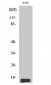 Somatostatin Polyclonal Antibody