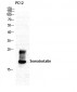 Somatostatin Polyclonal Antibody