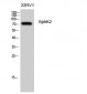 SphK2 Polyclonal Antibody