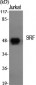 SRF Polyclonal Antibody