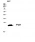 SRp20 Polyclonal Antibody