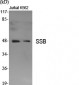 SSB Polyclonal Antibody