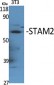 STAM2 Polyclonal Antibody