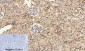 Stat3 Polyclonal Antibody