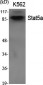 Stat5a Polyclonal Antibody