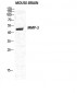 MMP-3 Polyclonal Antibody
