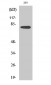 TACC3 Polyclonal Antibody