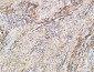 TGase2 Polyclonal Antibody