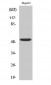 TGFβ RI Polyclonal Antibody