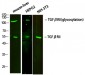 TGFβ RII Polyclonal Antibody