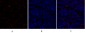 TGFβ RII Polyclonal Antibody