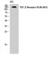 TGFβ RIII Polyclonal Antibody