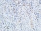 TGFβ1 Polyclonal Antibody