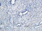 TGFβ1 Polyclonal Antibody