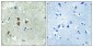 TGFβ1 Polyclonal Antibody