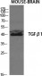 TGFβ1 Polyclonal Antibody