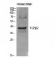 TGFβ2 Polyclonal Antibody