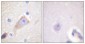 TH Polyclonal Antibody