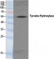 TH Polyclonal Antibody