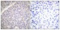 TH Polyclonal Antibody