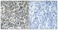 Thymidine Kinase Polyclonal Antibody