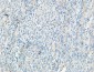 Tie-1 Polyclonal Antibody