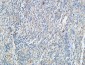 Tie-1 Polyclonal Antibody