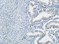 TIMP-1 Polyclonal Antibody