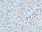 TIMP-1 Polyclonal Antibody