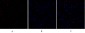 TIMP-1 Polyclonal Antibody