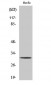 TIMP-3 Polyclonal Antibody